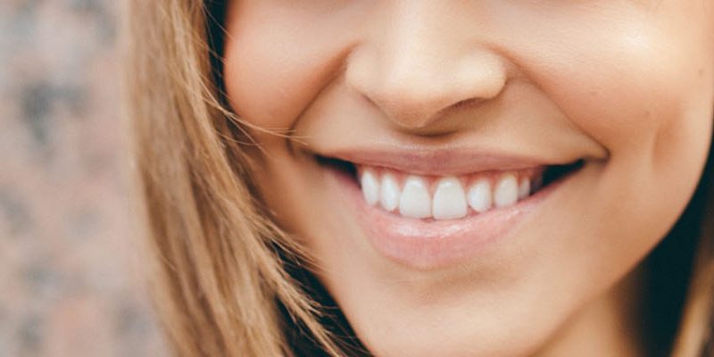 Fix Crooked Teeth