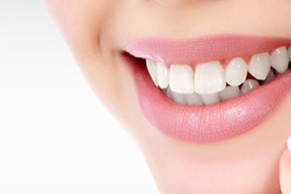Teeth Whitening in Hyderabad