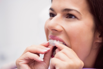 Importance of Dental Care After Braces