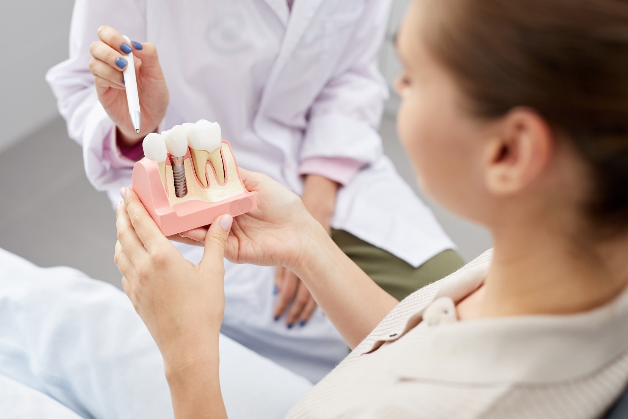 Types of Dental Implants