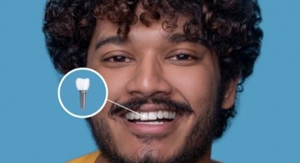 dental implants dental implants