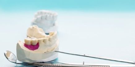 Bridges Vs Single Tooth Bridge - -positivedental
