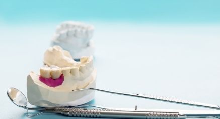 Bridges Vs Single Tooth Bridge - -positivedental