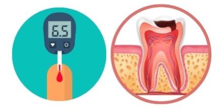 Dental Implants for Diabetics – Positivedental Dental Implants for Diabetics - Positivedental