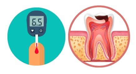 Dental Implants for Diabetics - Positivedental