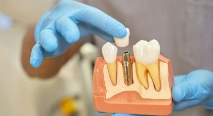 Dental Implants for Seniors -- Positive Dental