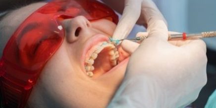 Overbite Teeth Treatment – Positive Dental Overbite Teeth Treatment - Positive Dental