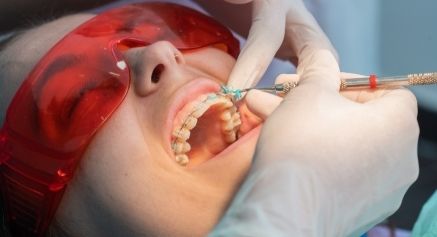 Overbite Teeth Treatment - Positive Dental